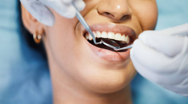 Best Emergency Dental Care for Broken or Chipped Teeth in Arcadia, LA